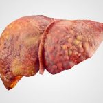 PT Health Watch: How Nigerians can prevent liver, kidney disease – Expert